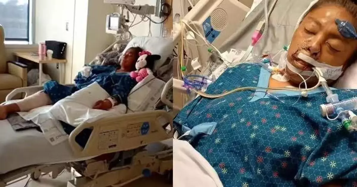 踩單車途中遇襲 美國女遭比特犬撲擊狂咬重創被截去四肢