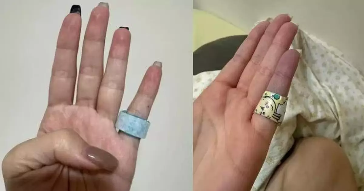 網瘋傳「退熱貼助眠法」有人使用不當手指險壞死 中醫師揭背後真相