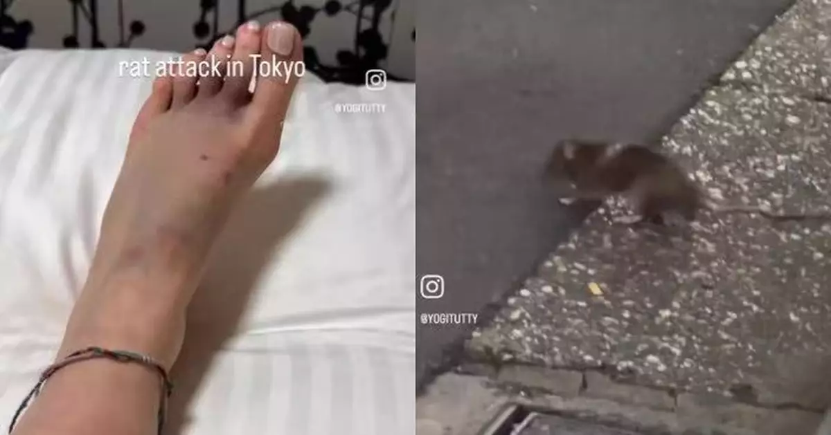 東京爆「鼠患危機」 杜拜女遊客新宿街頭遭咬傷腳背血流滿地