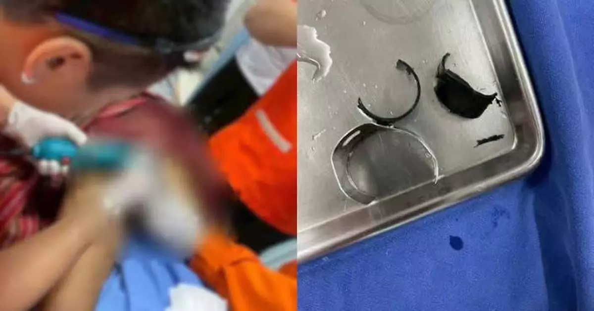 神志不清憂69cm大雕被偷走 泰男雙環鎖下體釀腫脹險毀命根