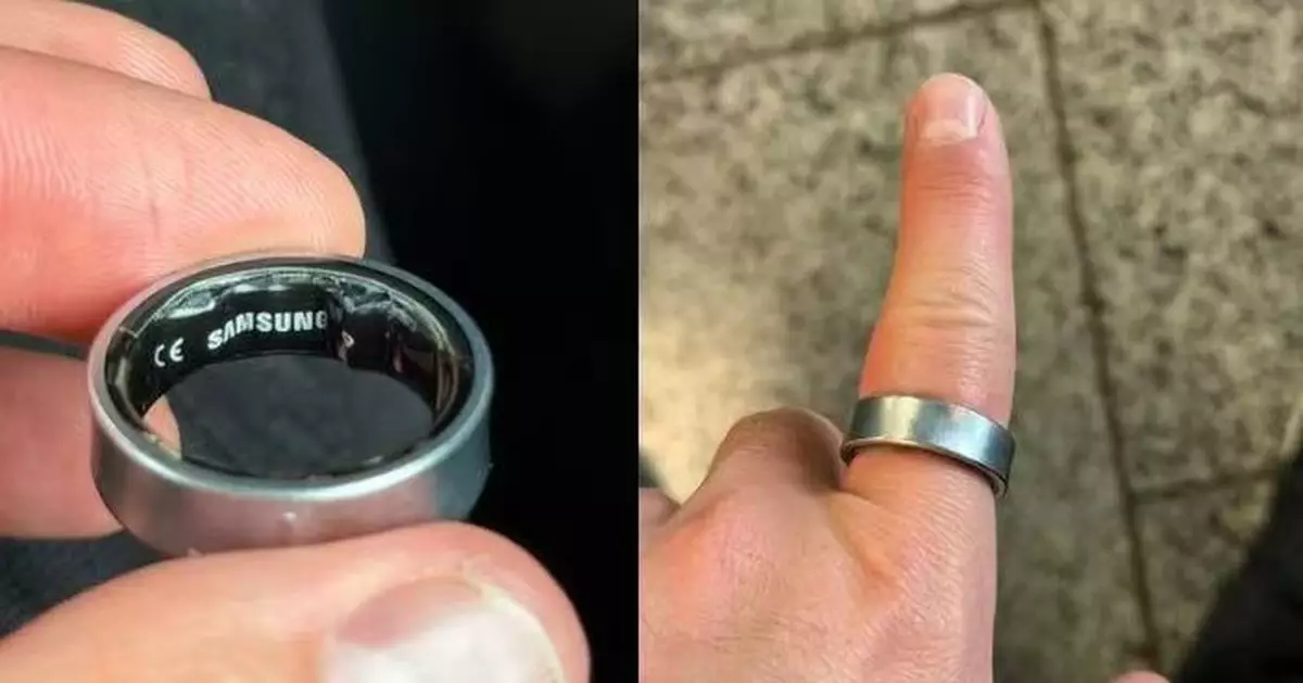 智能戒指電池鼓脹卡死手指 英漢遭拒登機緊急就醫拔出