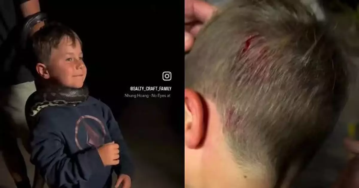 澳7歲男童夜遊動物園與蟒蛇互動突遭咬頭滲血 母親意外拍下驚險瞬間