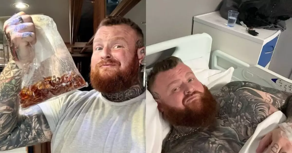 3日狂食3KG可樂軟糖致急性腸炎 英男入院揭「肚中充滿明膠」需禁食6日