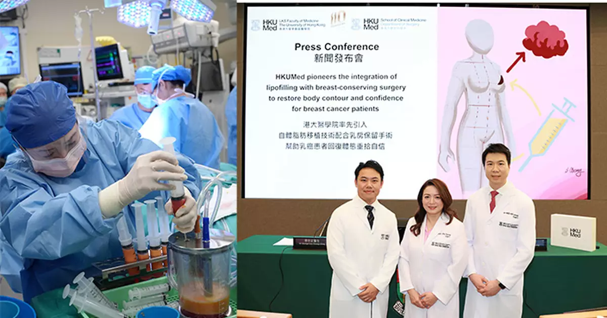 港大引入自體脂肪移植術 助乳癌患者重塑乳房重拾自信