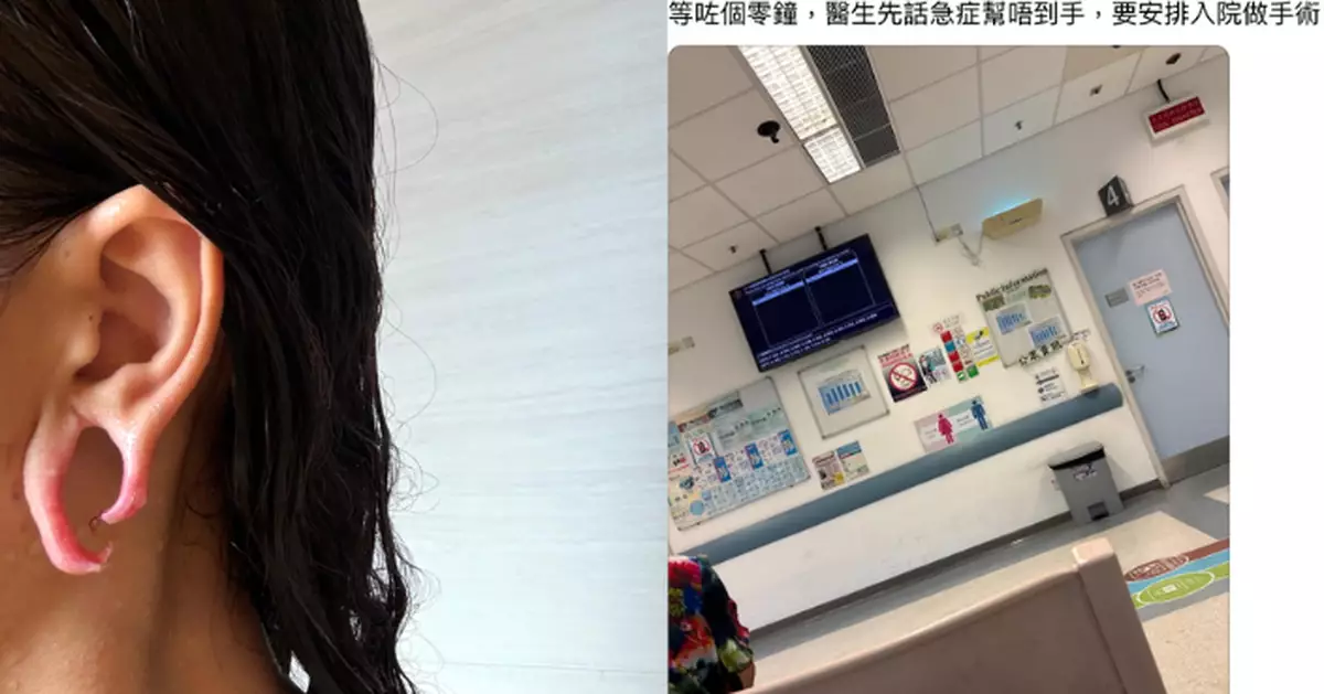 慎入！新潮流？網民持續擴耳致耳珠斷裂 恐怖畫面引驚呼：2025最奇怪Post​