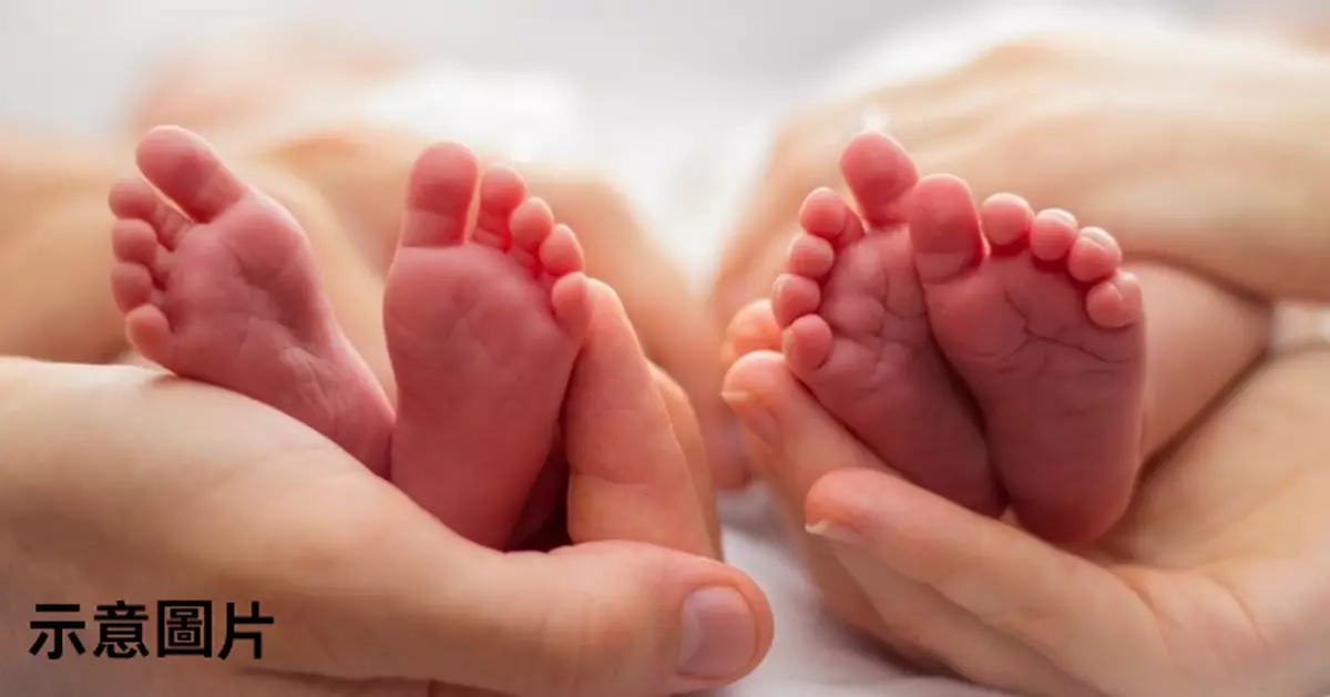 一晚與2男同房 巴西女誕孖胎驗DNA證「生父不同」 醫生揭1罕見狀況