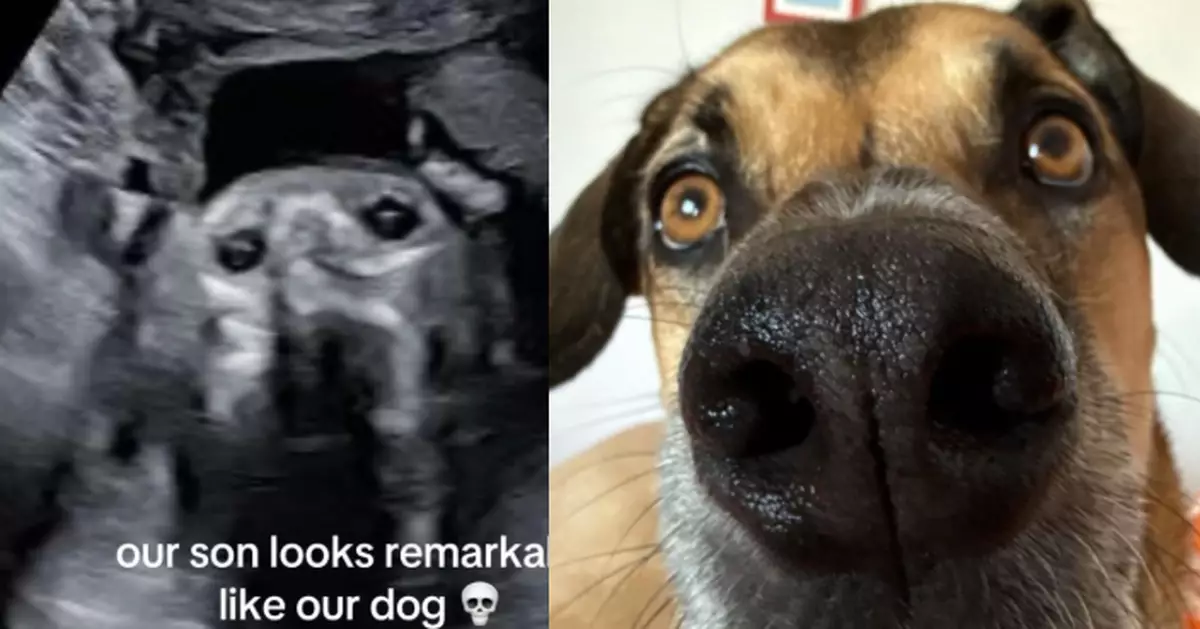 初見胎兒超聲波照 女子驚覺輪廓與愛犬「一模一樣」超驚訝