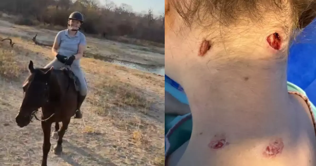 南非騎馬突遭獅子撲咬拖落地 瑞典女頸部重創脊椎斷裂奇蹟生還
