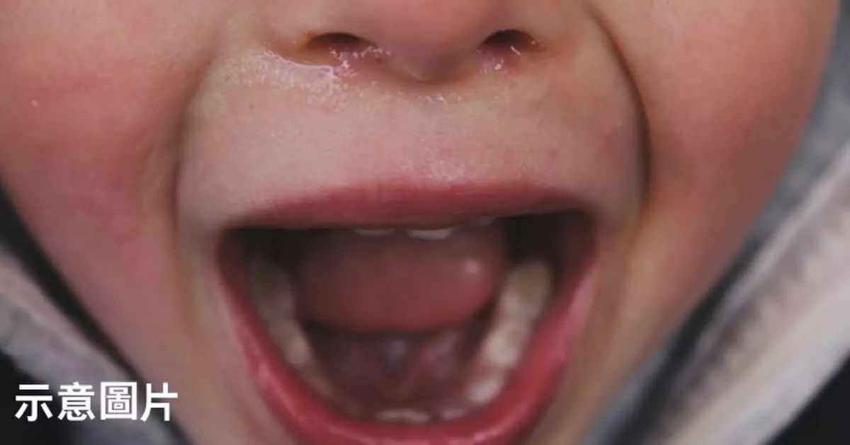 德女童飲麥當勞樽裝水突臉紅尖叫 母親聞到酒精味疑為清潔劑