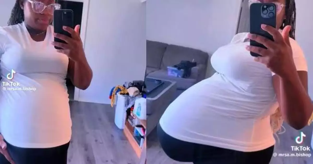 懷孖胎大到撐破子宮？ 美孕婦預產期前緊急開刀終平安生產