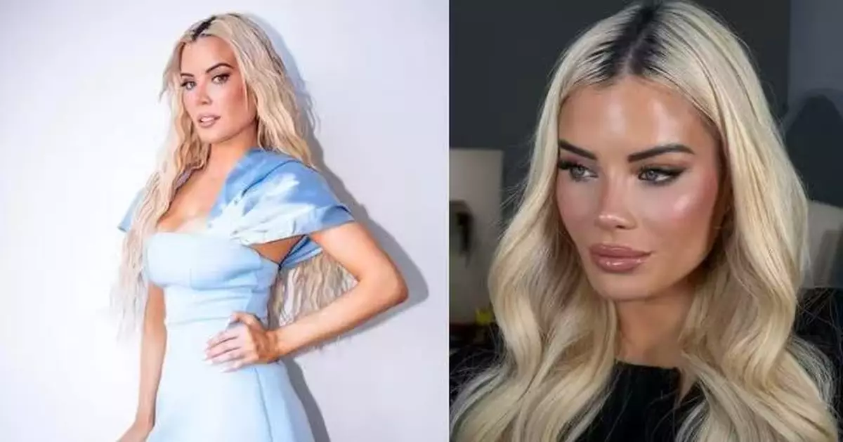 赴土耳其做眼部整形 英女模雙眼被蒙險遭潛入病房醫院男員工侵犯