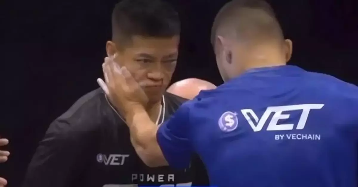 內地通背拳傳人參加兜巴星大賽 遭重擊眼重創視力或難復原