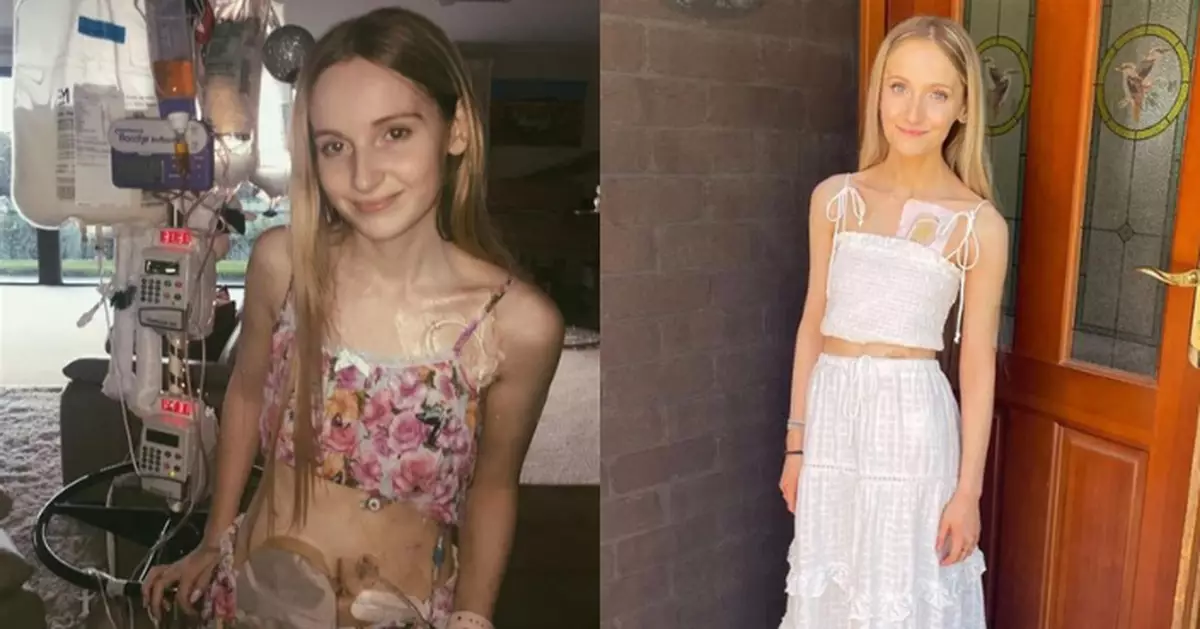 稱人生如「闖地雷區」 澳25歲女飽受罕病折磨 被允「安樂死」開心到喊