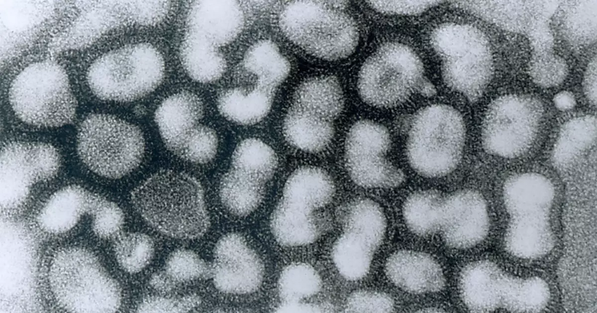 流感疫情持續升溫　日研究揭「這五類」人群感染風險最高！