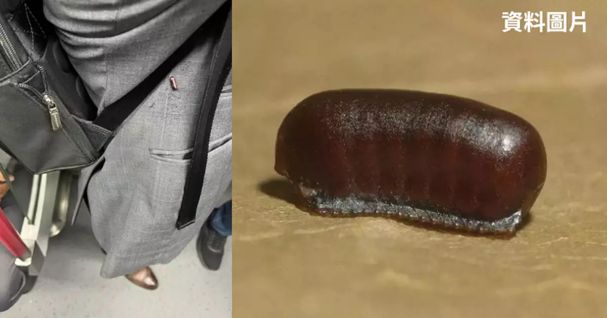 港鐵男乘客西裝黏附紅豆狀物體疑似「曱甴蛋」　網民嚇爆：幾污糟先會咁？