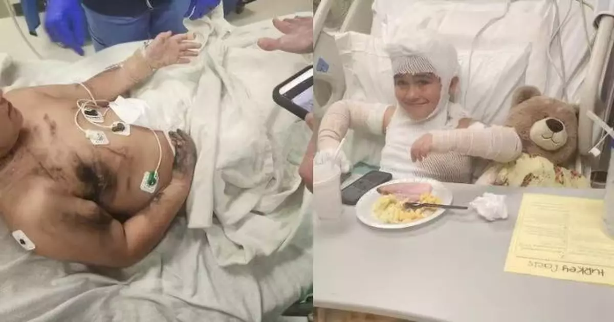 頸鍊卡插座起火點燃衣物 美男童頸部遭嚴重灼傷急扯斷自救逃一劫