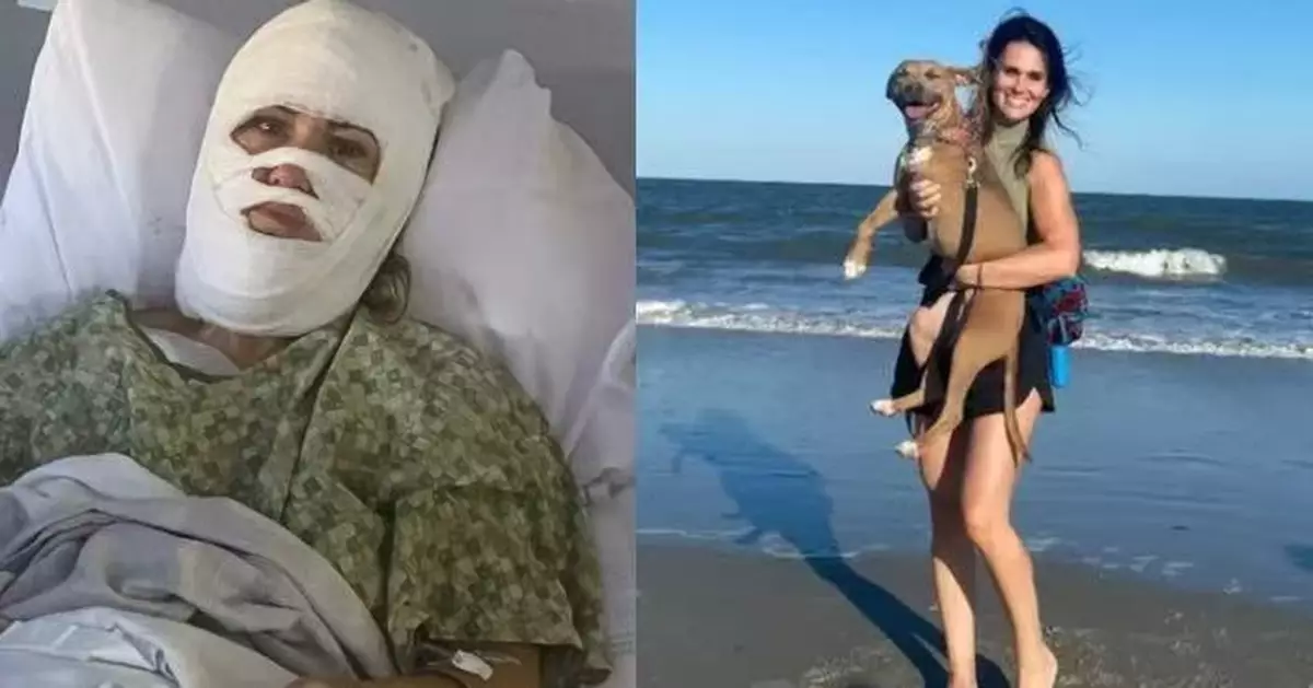 公園散步突遭陌生男潑腐蝕性化學液體 美國女近5成皮膚遭灼傷