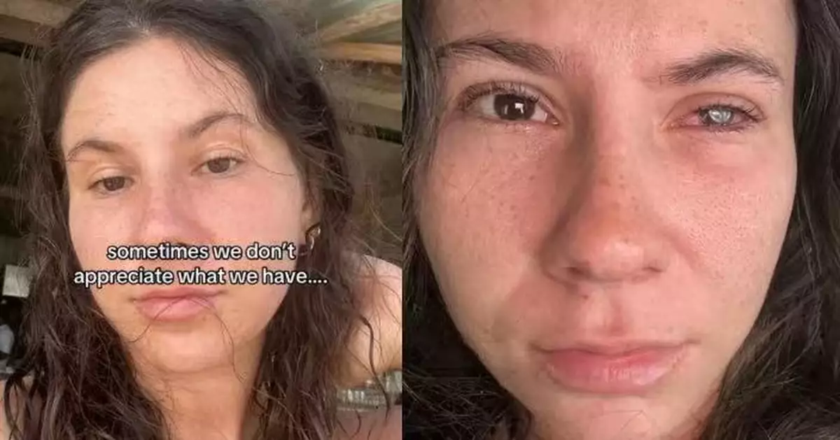 美國女右眼劇痛如刀割視力下降 就醫確診染「罕見寄生蟲」或因隱形眼鏡惹禍