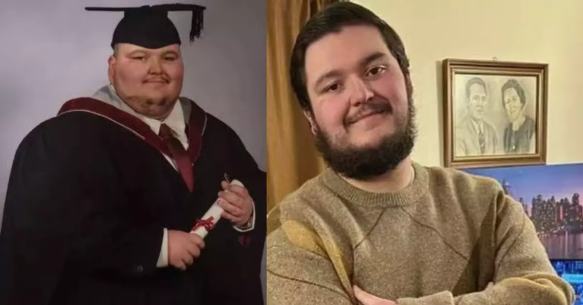 暴食體重飆近560磅健康堪憂 肥男未食藥打針靠踢波2年狂減近半體重