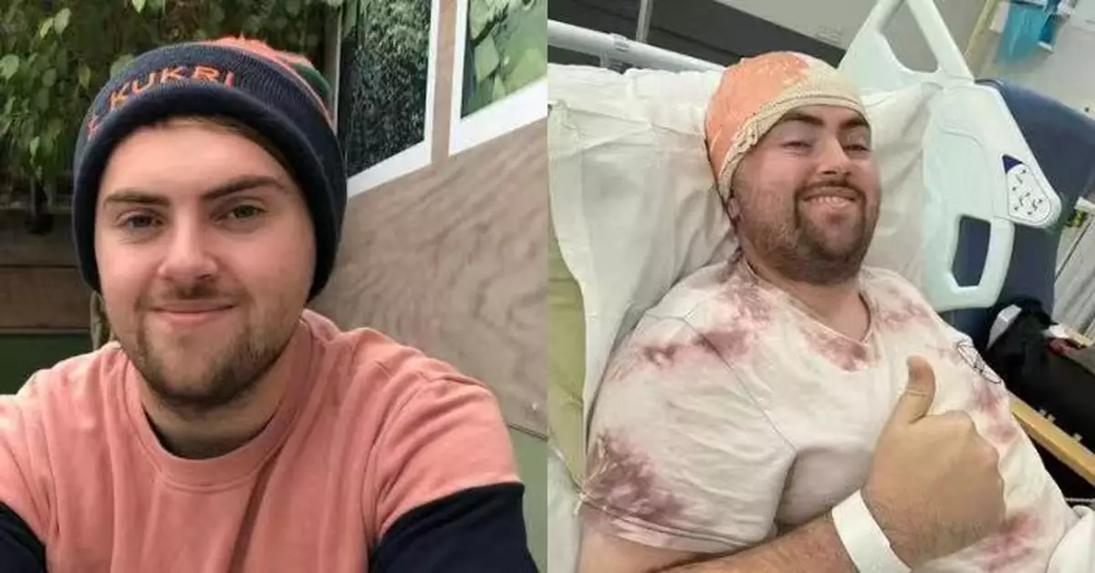 偏頭痛身體發麻誤當肌肉拉傷 英男突發癲癇就醫揭長腦瘤需清醒開顱