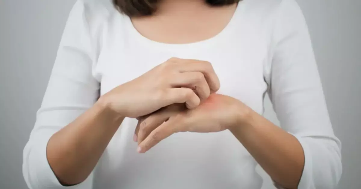 冬季皮膚痕癢多屬濕疹 專家指2常見習慣最傷皮膚 洗澡後3分鐘是保濕關鍵