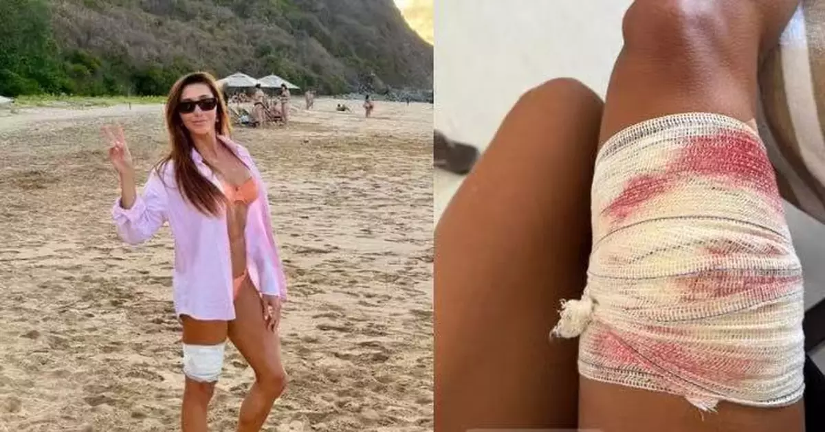 巴西女律師浮潛突遭鉸口鯊狠咬大腿不放 獲導遊出手相救死裡逃生