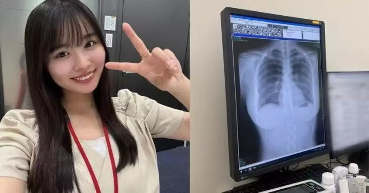 日寫真女星曬X光照稱「肺很乾淨」 清晰胸部線條展露無遺引熱議