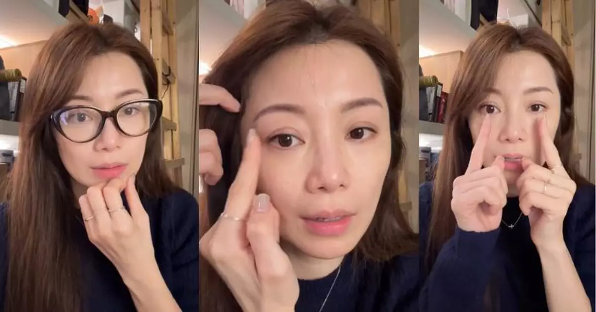 楊梓菁甲亢致眼凸憂盲 一年半治療終停藥