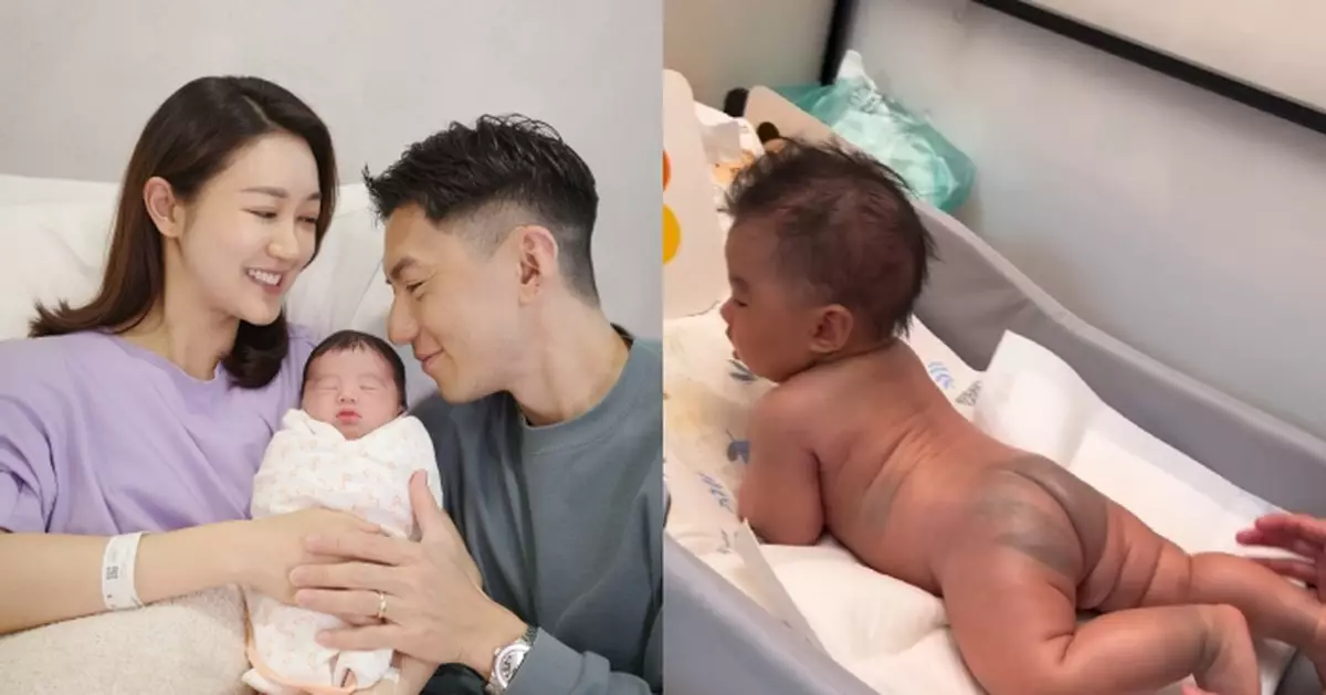 袁偉豪細仔全身出現大片深色斑塊 真相曝光屬常見先天胎痣