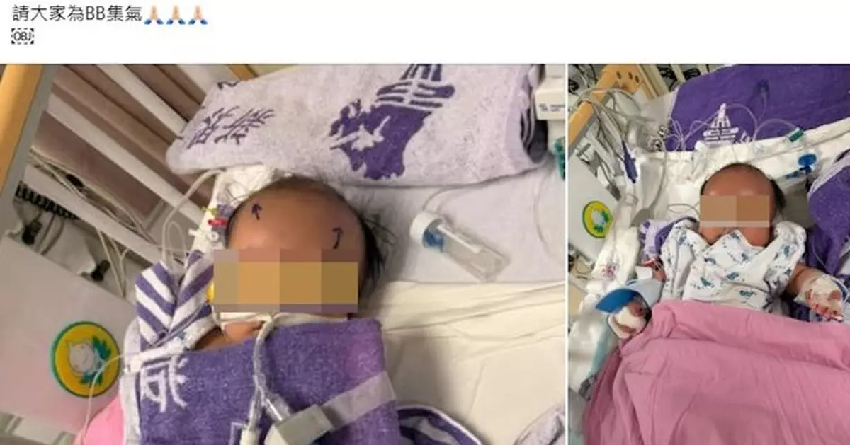 4月大男嬰上水疑遭大力搖晃及叉頸致腦出血 警拘兩名外傭