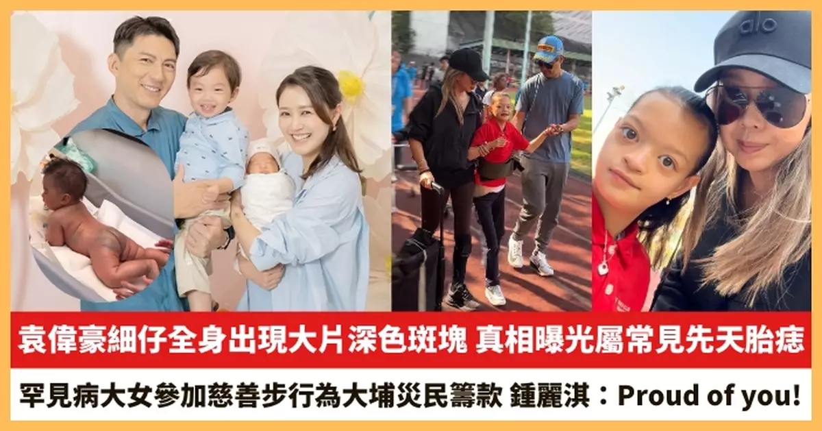 【2026.1.22娛圈熱點】袁偉豪細仔全身出現大片深色斑塊 鍾麗淇罕見病大女參加慈善步行為大埔災民籌款