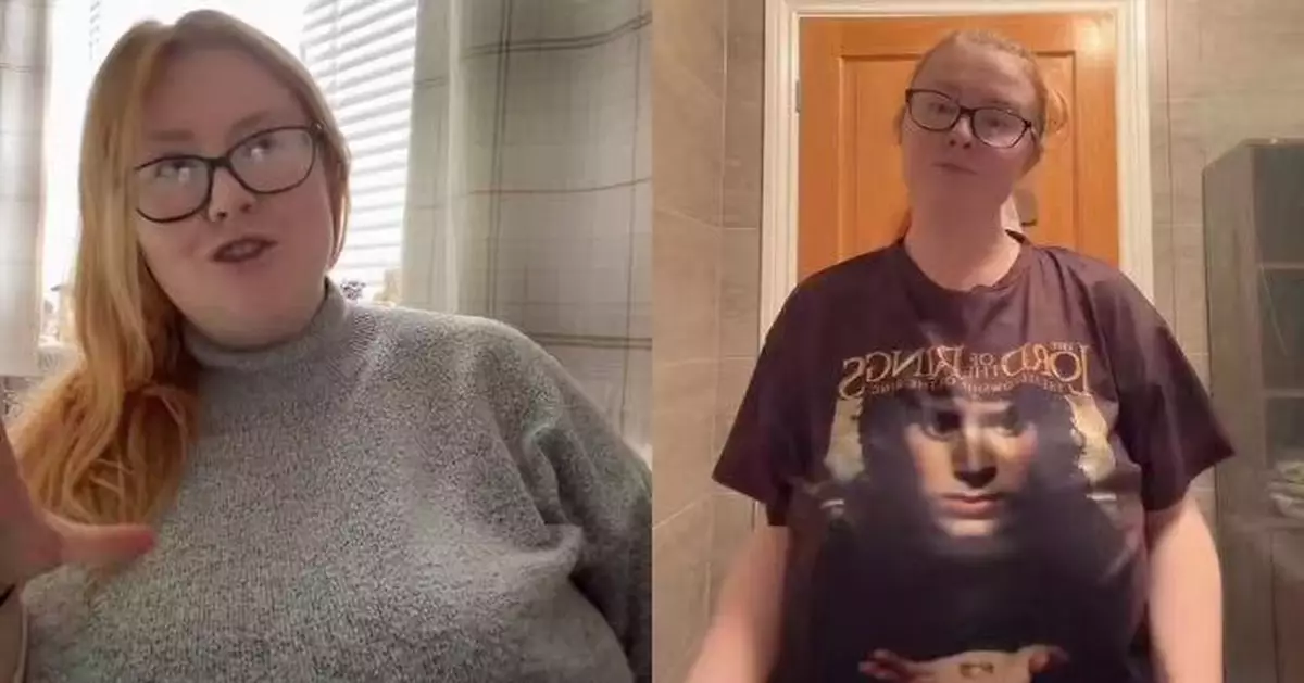 注射減肥藥減19KG 英女胸部反激升至N罩杯呼吸困難考慮縮胸保健康