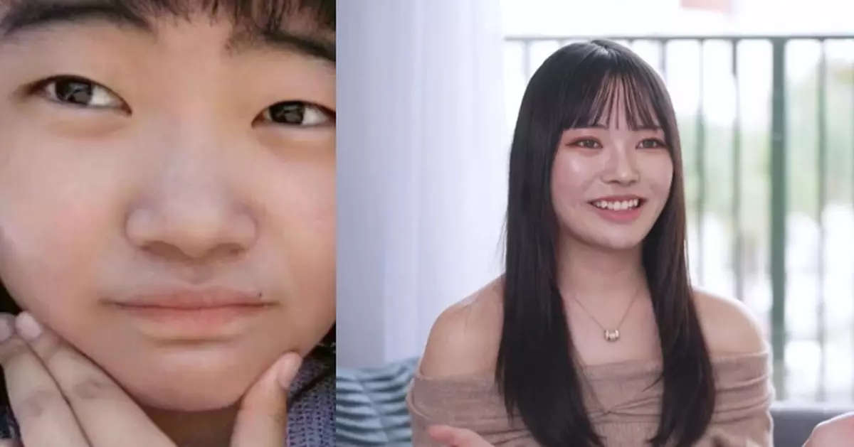 遭前度羞辱外貌自尊盡毀 日女大生豪斥逾百萬整形 換臉對比照震撼網民