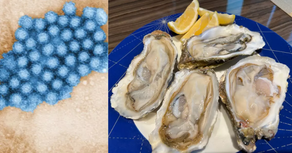 3周39宗食物中毒大部分涉諾如病毒 衞防中心再籲市民暫時勿食生蠔