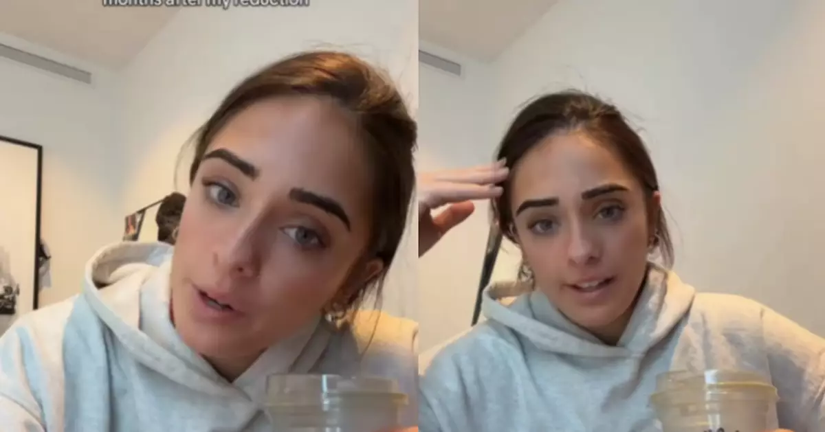 縮胸6周竟「長回原尺寸」 蘇格蘭女傻眼：錢白花了