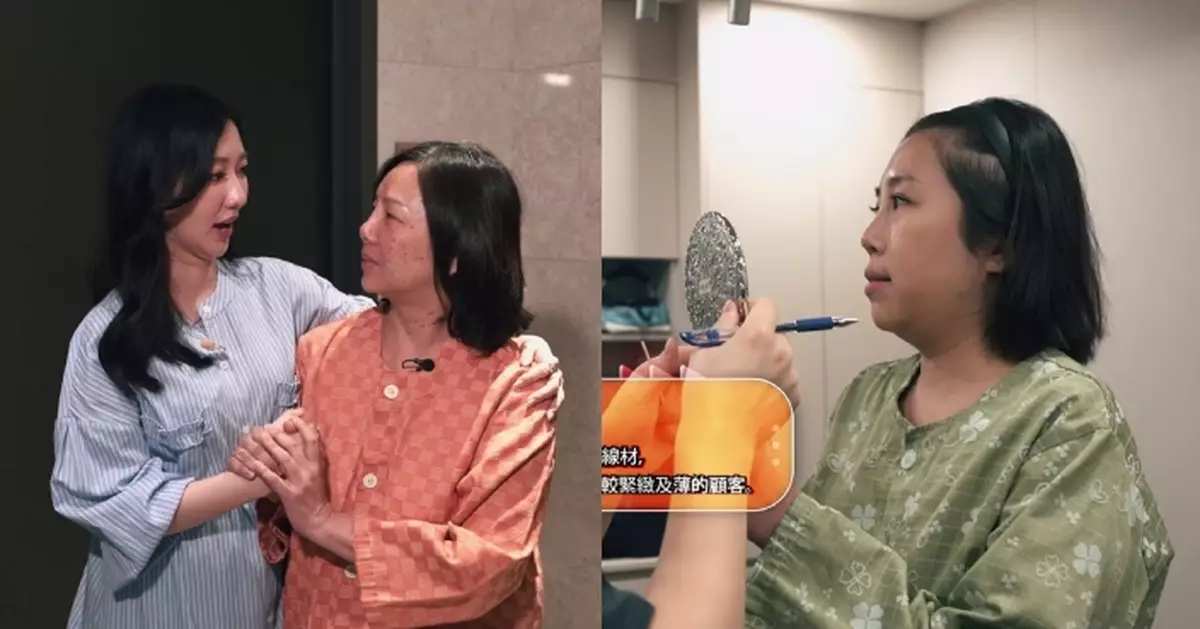 醫美直擊 首爾篇｜演員黃梓瑋割雙眼皮術前嚇到喊 素人Alex「埋線雙眼皮」免後患