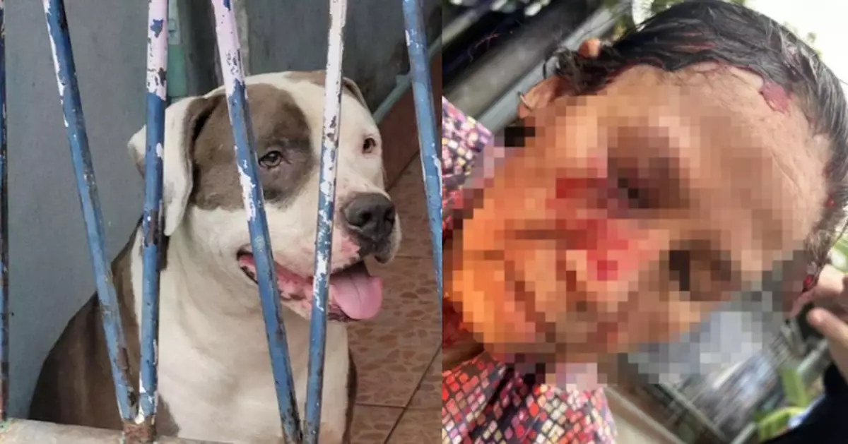 好心代收包裹 泰7旬婦遭鄰居4歲比特犬突襲咬傷頭臉爆血 地面留超長血跡