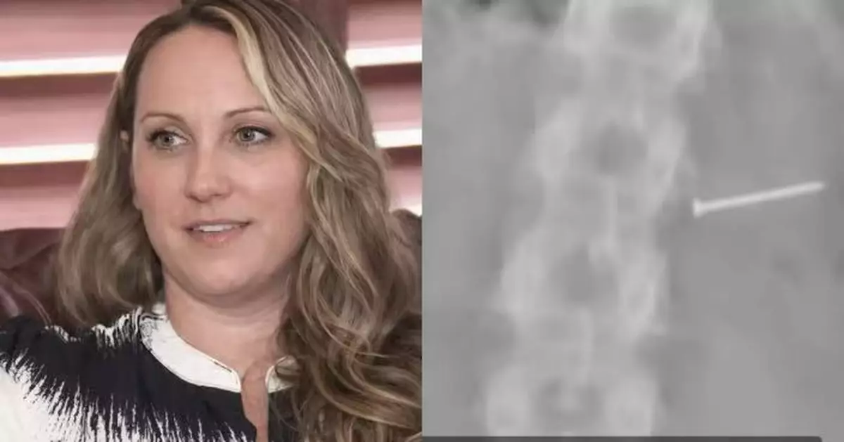 雪糕混入金屬釘及碎片 美國女誤當果仁吞落肚身體受創失生育能力獲賠1.1億