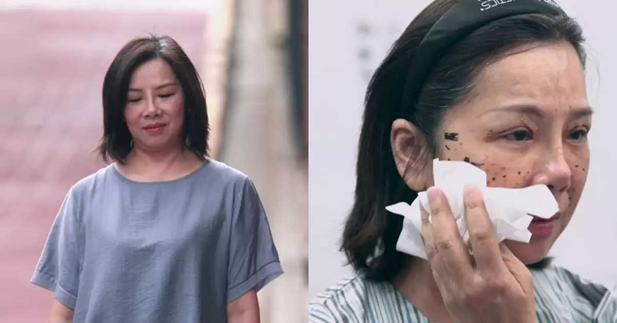 醫美直擊 首爾篇｜藝人黃梓瑋細說整容失敗陰影 醫美「埋線」14針為青春定格