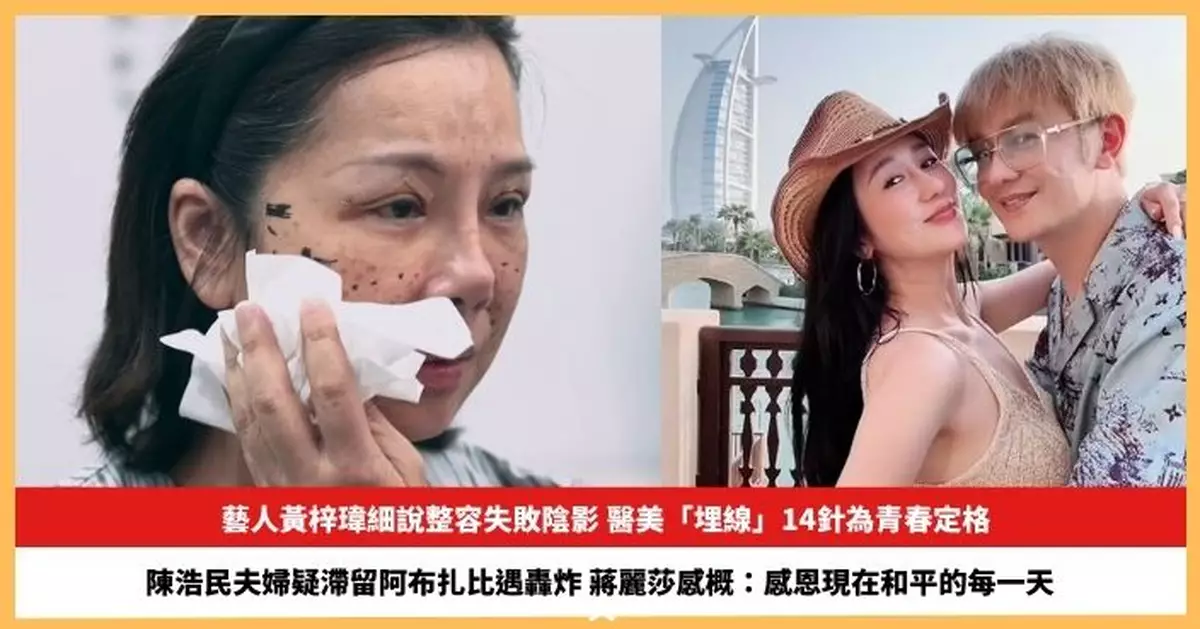 【2026.03.03娛圈熱點】藝人黃梓瑋細說整容失敗陰影 陳浩民夫婦疑滯留阿布扎比遇轟炸