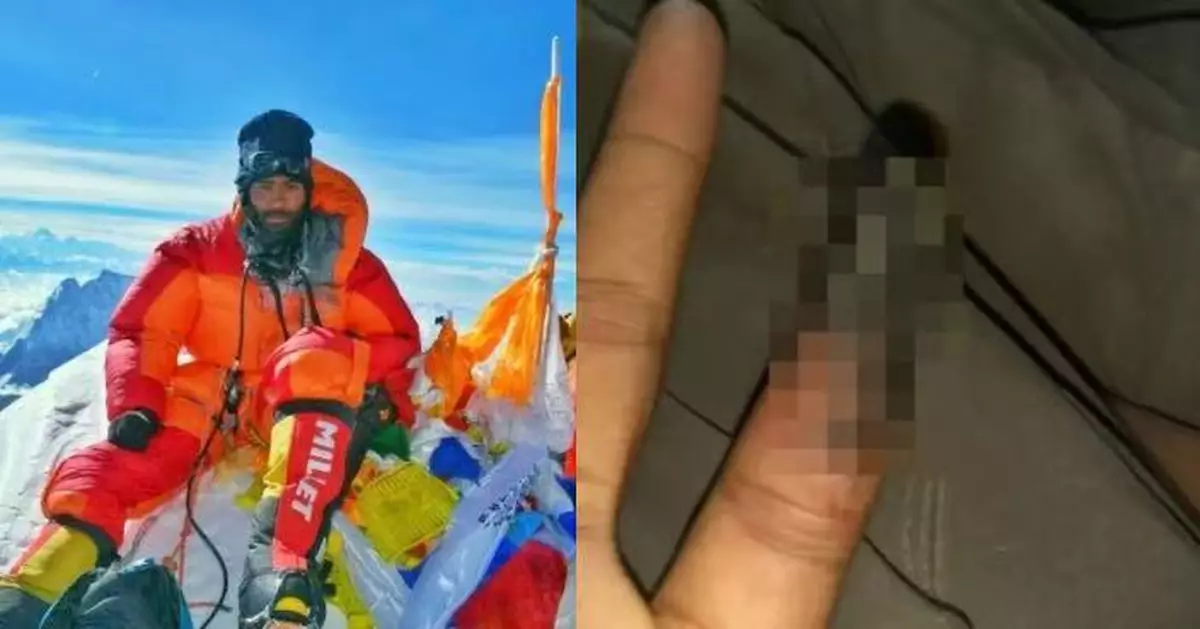 攀珠穆朗瑪峰為校相機除手套 印度登山客零下35度暴露手指4分鐘凍傷需截肢