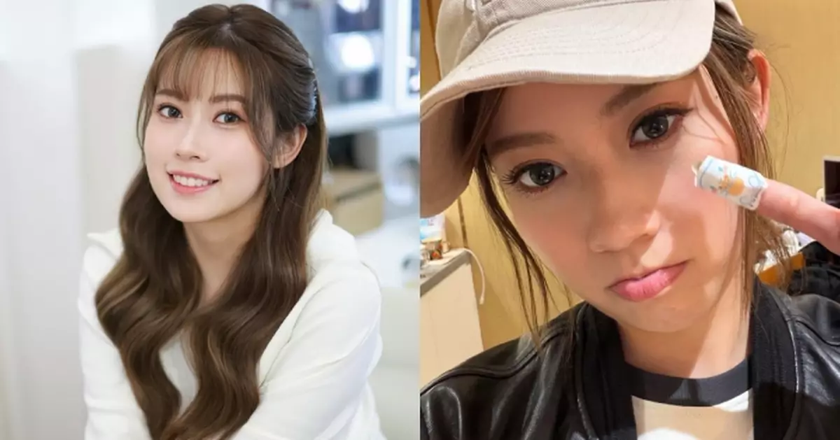 波波黃婧靈下廚意外切親手指 傷口慘遭二次受傷：飛到一地都係血