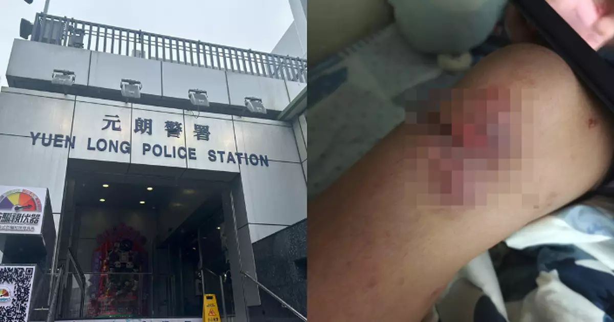 元朗13歲男童遭同學等欺凌襲擊勒索2.5萬元 警拘4男2女最細12歲