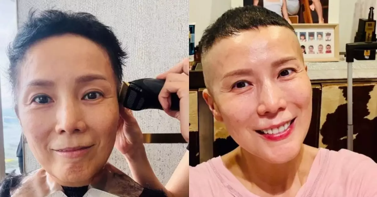 吳文忻因化療致脫髮自嘲變「癩痢」 剪「男仔頭」獲網民力撐：點剪都一樣好睇！