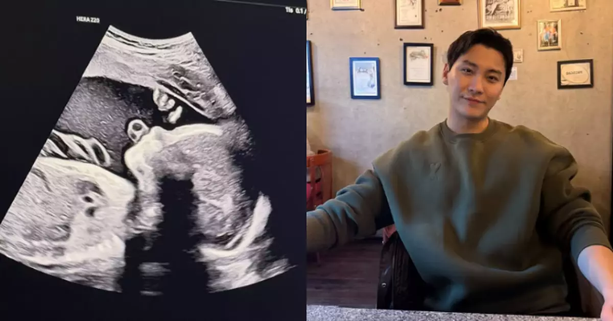 前FTISLAND宋承炫隱退兩年轉戰飲食業 宣布即將升為人父