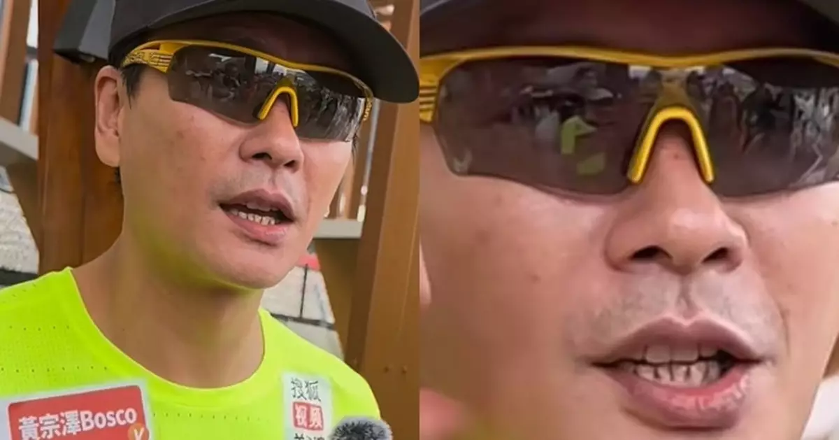 黃宗澤被指「牙齦萎縮」登熱搜 近鏡曝光嚇窒網民