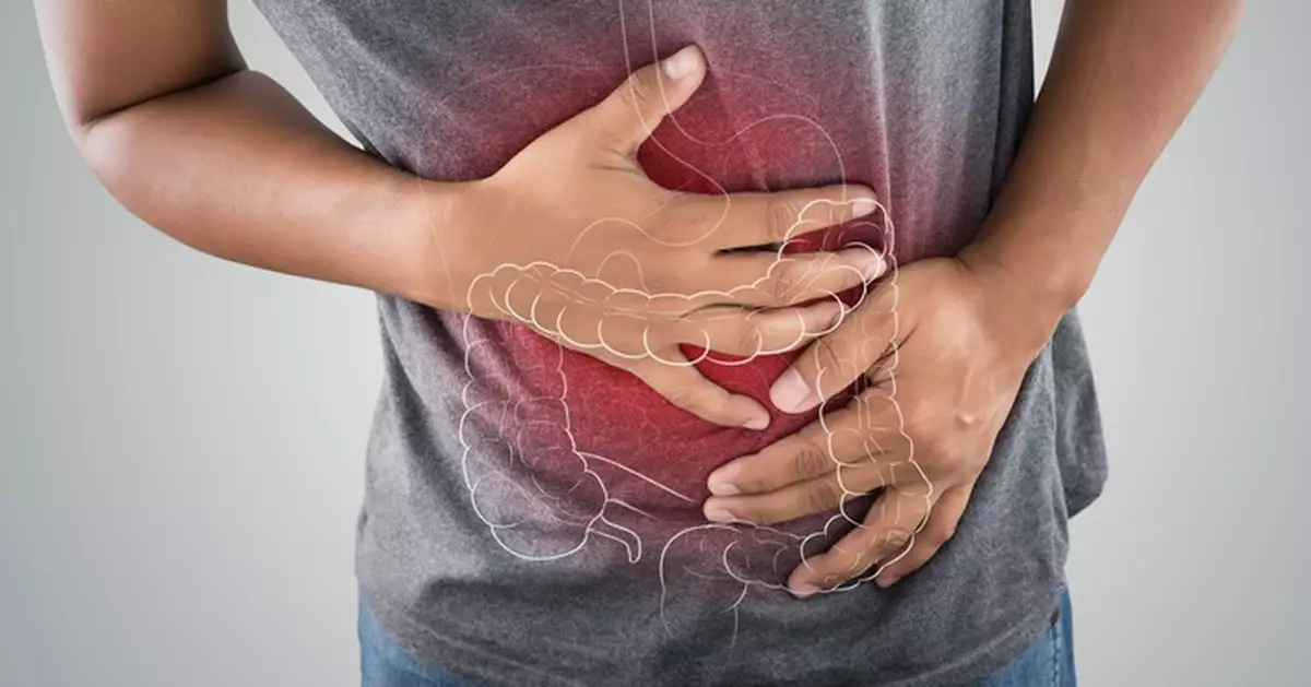 倫敦大學學院腸癌新藥試驗奏效 32名患者病情全受控 英醫：近6成腫瘤消失