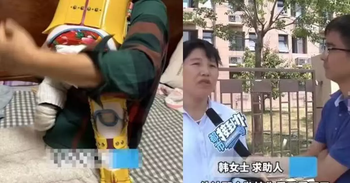 浙江幼師跣腳跌坐女童身上致其右腿骨折 家屬索償逾10萬 園方拒對簿公堂