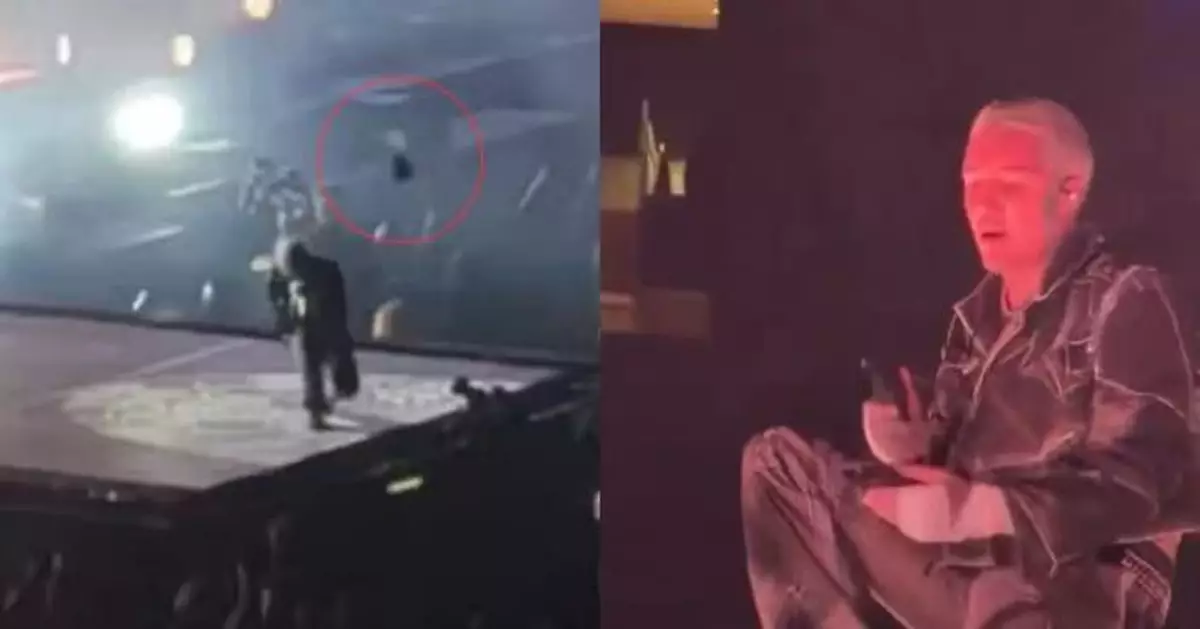 遭粉絲亂掟手機砸中頭部 英樂團主唱忍痛完成演出 事後確診輕微腦震盪