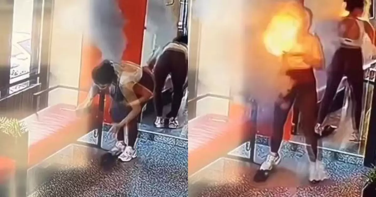 尿袋放背包突冒煙爆炸 哈薩克女網紅頭頸手臂遭嚴重燒傷